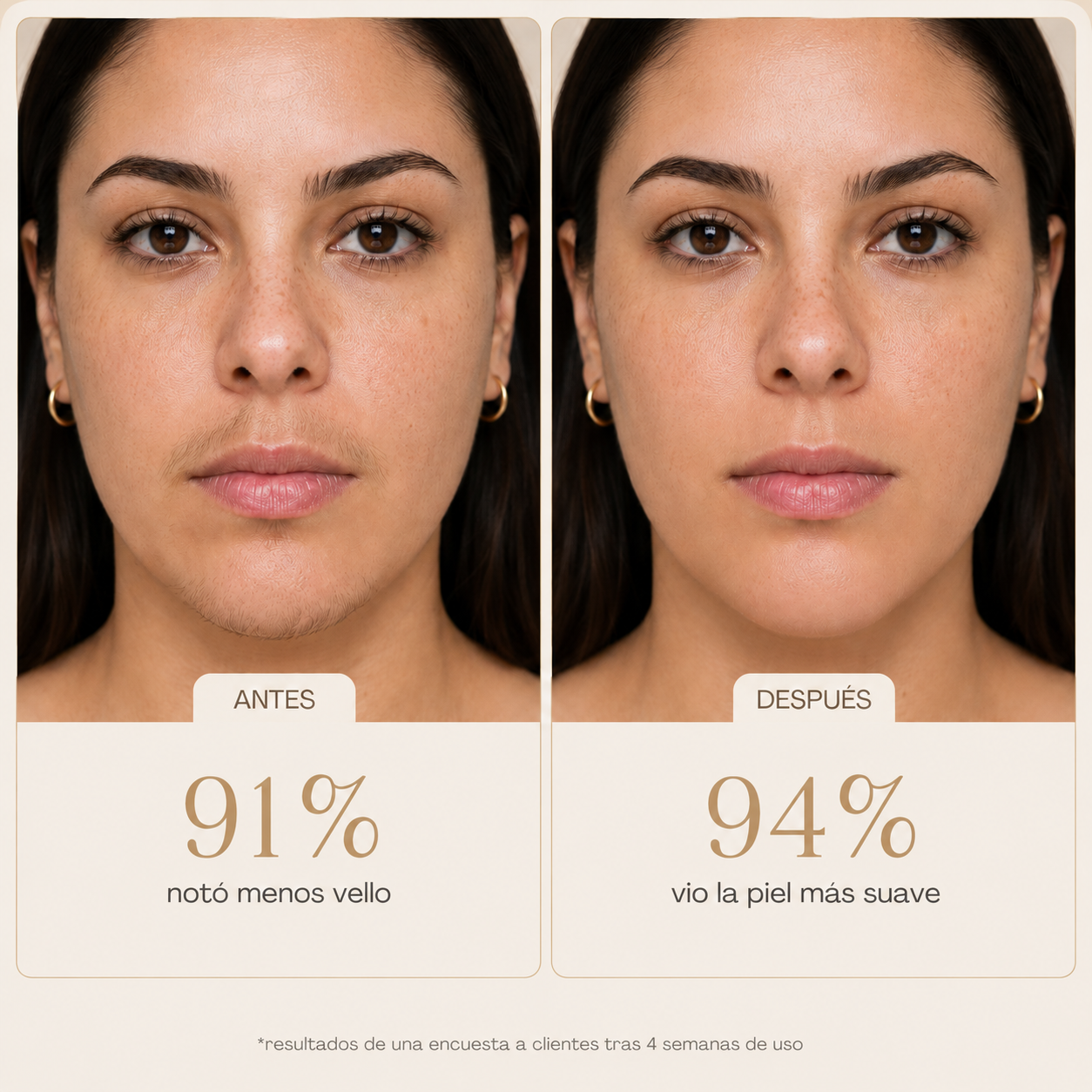 Aceite Anti-Vello Natural - Menos Vello Desde la Primera Semana