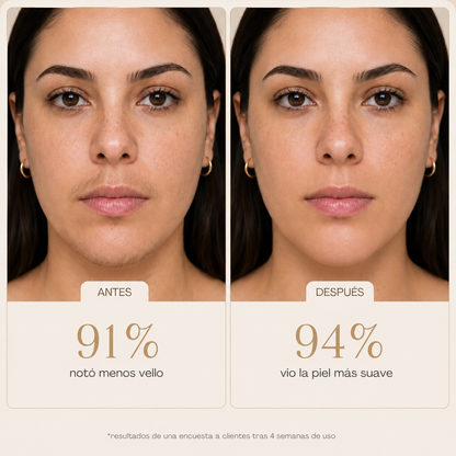 Aceite Anti-Vello Natural - Menos Vello Desde la Primera Semana